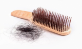 Основные причины выпадения волос и как с этим бороться